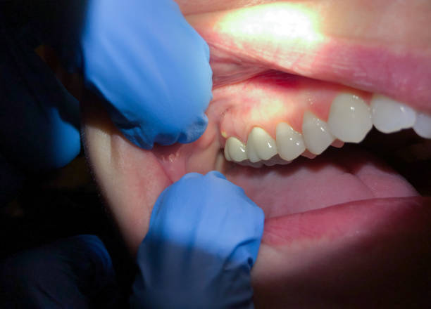 Best Broken Tooth Emergency  in Richfield, UT