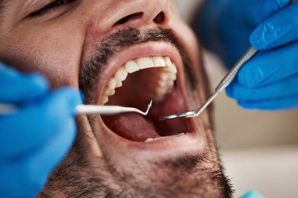 Best Urgent Tooth Repair  in Richfield, UT
